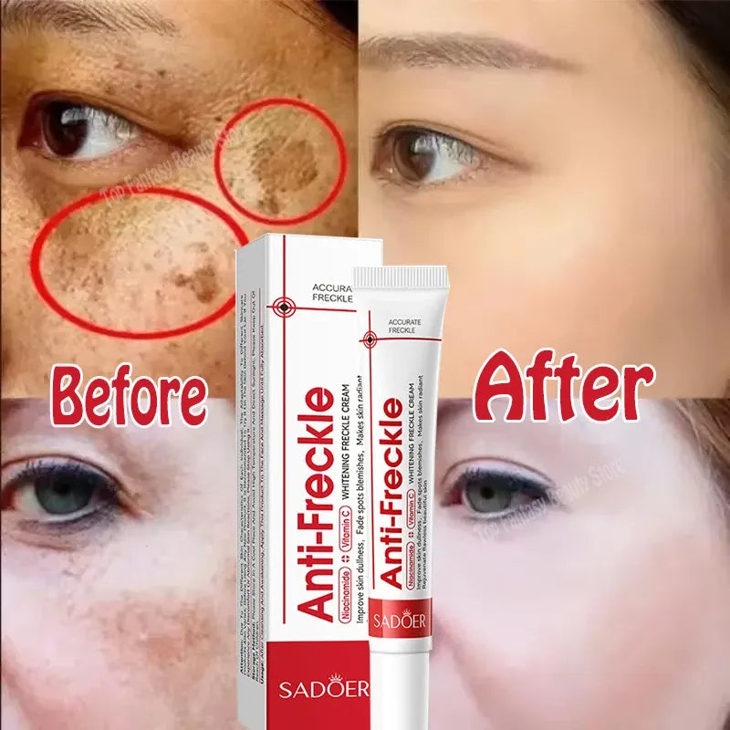 Pack 2 Cremas Facial Blanqueadora Sadoer - vista 5